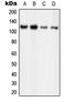 Origin Recognition Complex Subunit 1 antibody, MBS821866, MyBioSource, Western Blot image 