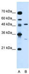 Colony Stimulating Factor 1 antibody, TA335256, Origene, Western Blot image 