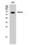 Protein enabled homolog antibody, A05337-1, Boster Biological Technology, Western Blot image 