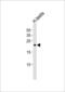 Fetal And Adult Testis Expressed 1 antibody, PA5-49354, Invitrogen Antibodies, Western Blot image 