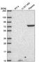 Dopamine Beta-Hydroxylase antibody, HPA070789, Atlas Antibodies, Western Blot image 