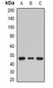 Serine hydroxymethyltransferase, cytosolic antibody, orb341339, Biorbyt, Western Blot image 