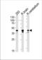 Casein Kinase 2 Alpha 1 antibody, TA328199, Origene, Western Blot image 