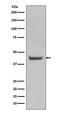 SRY-Box 18 antibody, M04004, Boster Biological Technology, Western Blot image 