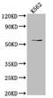 UDP-N-Acetylglucosamine Pyrophosphorylase 1 antibody, CSB-RA174034A0HU, Cusabio, Western Blot image 