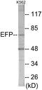 Tripartite Motif Containing 25 antibody, EKC1807, Boster Biological Technology, Western Blot image 