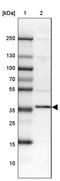 Phosphatidylserine synthase 1 antibody, PA5-53505, Invitrogen Antibodies, Western Blot image 