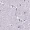 Secreted frizzled-related protein 4 antibody, PA5-52679, Invitrogen Antibodies, Immunohistochemistry paraffin image 
