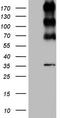 ALK Receptor Tyrosine Kinase antibody, CF801099, Origene, Western Blot image 