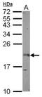 Fibroblast Growth Factor 12 antibody, NBP2-14956, Novus Biologicals, Western Blot image 