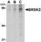 Corticotropin Releasing Hormone Receptor 2 antibody, orb5915, Biorbyt, Western Blot image 