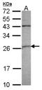 Glutathione S-Transferase Alpha 4 antibody, NBP1-32229, Novus Biologicals, Western Blot image 