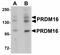 PR/SET Domain 16 antibody, LS-B4625, Lifespan Biosciences, Western Blot image 