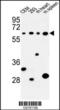 Phospholipase C Zeta 1 antibody, 63-939, ProSci, Western Blot image 