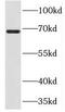 Protein arginine N-methyltransferase 3 antibody, FNab06790, FineTest, Western Blot image 