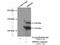 RNA Binding Motif Protein 10 antibody, 14423-1-AP, Proteintech Group, Immunoprecipitation image 