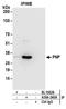 PNP antibody, A304-240A, Bethyl Labs, Immunoprecipitation image 