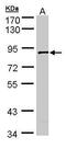 SCY1 Like Pseudokinase 3 antibody, PA5-21496, Invitrogen Antibodies, Western Blot image 