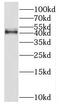 Hydroxysteroid 11-Beta Dehydrogenase 2 antibody, FNab04022, FineTest, Western Blot image 