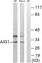 Androgen Induced 1 antibody, GTX87301, GeneTex, Western Blot image 