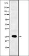 RAB33B, Member RAS Oncogene Family antibody, orb338622, Biorbyt, Western Blot image 