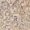 Placenta Associated 8 antibody, FNab06511, FineTest, Immunohistochemistry paraffin image 