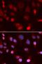 ATPase Copper Transporting Beta antibody, orb167508, Biorbyt, Immunofluorescence image 