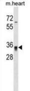 Homeobox protein Hox-C8 antibody, abx029437, Abbexa, Western Blot image 