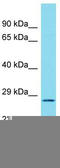 Chromosome 17 Open Reading Frame 77 antibody, TA333482, Origene, Western Blot image 