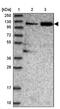Transforming Growth Factor Beta Receptor Associated Protein 1 antibody, PA5-58374, Invitrogen Antibodies, Western Blot image 