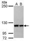 Importin 5 antibody, PA5-30076, Invitrogen Antibodies, Western Blot image 