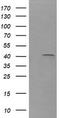 Parvin Alpha antibody, TA505997AM, Origene, Western Blot image 