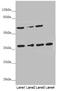 ERLIN2 antibody, LS-C675723, Lifespan Biosciences, Western Blot image 