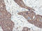 Phosphofructokinase, Platelet antibody, LS-C337563, Lifespan Biosciences, Immunohistochemistry frozen image 