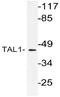 TAL BHLH Transcription Factor 1, Erythroid Differentiation Factor antibody, AP21141PU-N, Origene, Western Blot image 