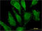 Microsomal Glutathione S-Transferase 3 antibody, LS-C197681, Lifespan Biosciences, Immunofluorescence image 