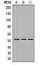 Solute Carrier Family 29 Member 3 antibody, LS-C668466, Lifespan Biosciences, Western Blot image 