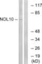 Nucleolar Protein 10 antibody, LS-C199335, Lifespan Biosciences, Western Blot image 
