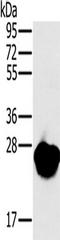 Myosin light chain 3 antibody, TA350194, Origene, Western Blot image 