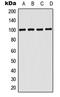 Ectonucleotide Pyrophosphatase/Phosphodiesterase 3 antibody, MBS820307, MyBioSource, Western Blot image 