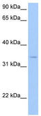 Pyridoxal kinase antibody, TA335764, Origene, Western Blot image 