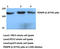 Platelet Derived Growth Factor Receptor Beta antibody, AP20718PU-N, Origene, Western Blot image 