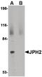 Junctophilin 2 antibody, PA5-20641, Invitrogen Antibodies, Western Blot image 