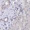 Protein Phosphatase 2 Regulatory Subunit Bbeta antibody, NBP2-46667, Novus Biologicals, Immunohistochemistry frozen image 
