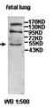 Putative disintegrin and metalloproteinase domain-containing protein 5 antibody, orb77494, Biorbyt, Western Blot image 