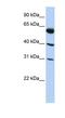 LysM Domain Containing 4 antibody, NBP1-62190, Novus Biologicals, Western Blot image 