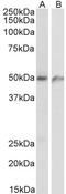 Endothelial Cell Surface Expressed Chemotaxis And Apoptosis Regulator antibody, STJ70551, St John