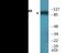 Minichromosome Maintenance Complex Component 4 antibody, EKC2250, Boster Biological Technology, Western Blot image 