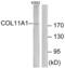 Collagen Type XI Alpha 1 Chain antibody, TA313664, Origene, Western Blot image 