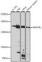 Mitogen-activated protein kinase kinase kinase 1 antibody, 16-403, ProSci, Western Blot image 